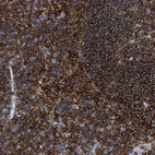 Anti-LCP1 Antibody