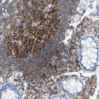 Immunohistochemical staining of human rectum shows strong cytoplasmic positivity in lymphoid cells.