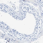 Immunohistochemical staining of human testis shows no cytoplasmic positivity in cells in seminiferous ducts as expected.