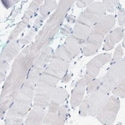 Immunohistochemical staining of human skeletal muscle shows no cytoplasmic positivity in myocytes as expected.