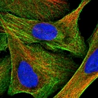 Immunofluorescent staining of human cell line U-2 OS shows localization to plasma membrane, cytosol & actin filaments.