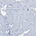 Immunohistochemical staining of human skeletal muscle shows low expression as expected.