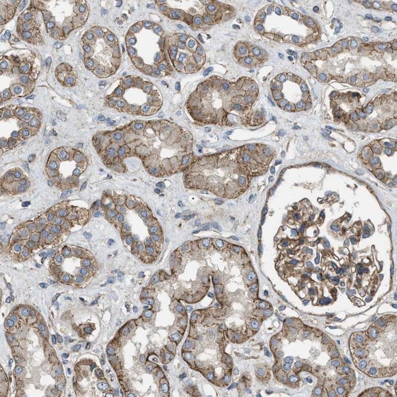 Anti-ERC1 Antibody