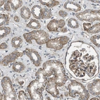 Anti-ERC1 Antibody