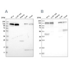 Western blot analysis using Anti-ERC1 antibody HPA019513 (A) shows similar pattern to independent antibody HPA019523 (B).
