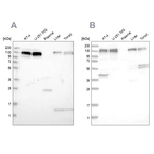Western blot analysis using Anti-ERC1 antibody HPA019513 (A) shows similar pattern to independent antibody HPA019523 (B).