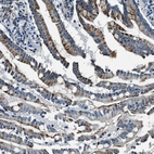 Immunohistochemical staining of human small intestine shows moderate granular cytoplasmic positivity in glandular cells.