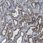 Immunohistochemical staining of human kidney shows moderate granular cytoplasmic positivity in cells in tubules.