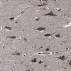 Immunohistochemical staining of human cerebral cortex shows moderate granular cytoplasmic positivity in neurons.