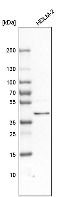 Western blot analysis in human cell line HDLM-2.