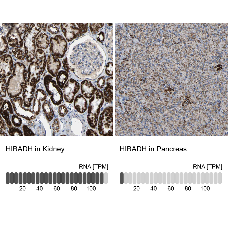Anti-HIBADH Antibody