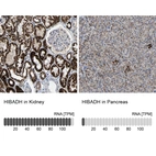 Anti-HIBADH Antibody