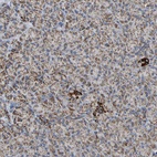 Immunohistochemical staining of human pancreas shows low expression as expected.