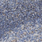 Immunohistochemical staining of human lymph node using Anti-HIBADH antibody HPA019522.