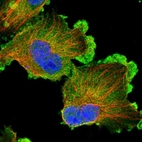 Immunofluorescent staining of human cell line U-251 MG shows localization to plasma membrane & cytosol.