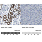 Anti-AMACR Antibody