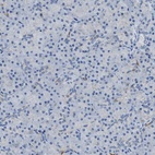 Immunohistochemical staining of human pancreas shows low expression as expected.