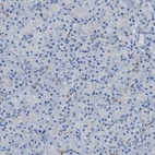 Anti-AMACR Antibody