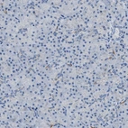 Immunohistochemical staining of human pancreas shows low expression as expected.