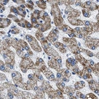 Immunohistochemical staining of human liver using Anti-AMACR antibody HPA019527.