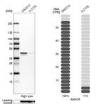 Western blot analysis in human cell lines Caco-2 and U2OS using Anti-AMACR antibody. Corresponding AMACR RNA-seq data are presented for the same cell lines. Loading control: Anti-GAPDH.