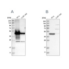 Anti-AMACR Antibody