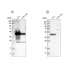 Western blot analysis using Anti-AMACR antibody HPA019527 (A) shows similar pattern to independent antibody HPA020912 (B).