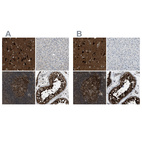 Anti-NUDCD3 Antibody