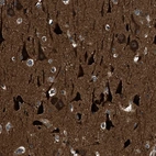 Immunohistochemical staining of human cerebral cortex shows strong cytoplasmic positivity in neurons.