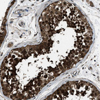 Immunohistochemical staining of human testis shows strong cytoplasmic positivity in cells in seminiferous ducts.