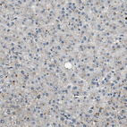 Immunohistochemical staining of human liver shows no positivity in hepatocytes as expected.