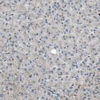 Anti-NUDCD3 Antibody