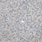 Immunohistochemical staining of human liver shows no positivity in hepatocytes as expected.