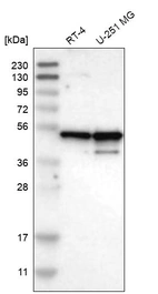 Western blot analysis in human cell line RT-4 and human cell line U-251 MG.