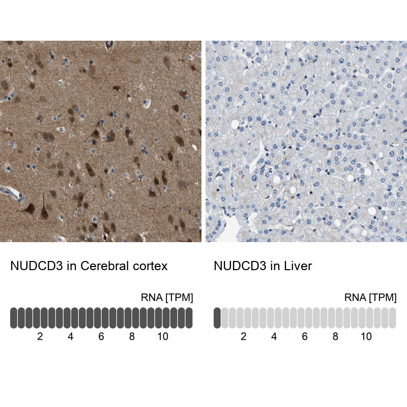 Anti-NUDCD3 Antibody