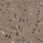 Immunohistochemical staining of human cerebral cortex shows high expression.