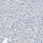 Anti-NUDCD3 Antibody