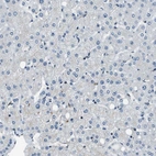 Immunohistochemical staining of human liver shows low expression as expected.