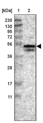 Lane 1: Marker [kDa] 230, 130, 95, 72, 56, 36, 28, 17, 11_br/_Lane 2: Human cell line RT-4