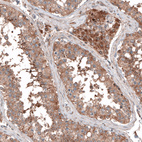 Immunohistochemical staining of human testis shows moderate to strong cytoplasmic positivity in cells in seminiferous ducts.