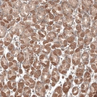Immunohistochemical staining of human stomach shows moderate to strong cytoplasmic positivity in glandular cells.