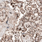 Immunohistochemical staining of human placenta shows strong positivity in erythrocytes.