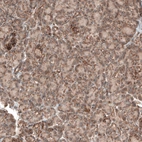 Immunohistochemical staining of human pancreas shows moderate cytoplasmic positivity in exocrine glandular cells.