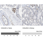 Anti-C22orf42 Antibody