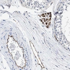 Immunohistochemical staining of human testis shows high expression.