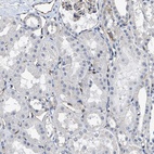 Anti-C22orf42 Antibody