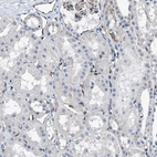 Immunohistochemical staining of human kidney shows low expression as expected.