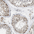 Anti-ELAC2 Antibody