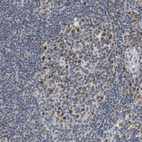 Immunohistochemical staining of human lymph node shows moderate to strong nuclear positivity in germinal center cells.