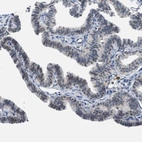 Immunohistochemical staining of human fallopian tube shows weak to moderate nuclear positivity in glandular cells.